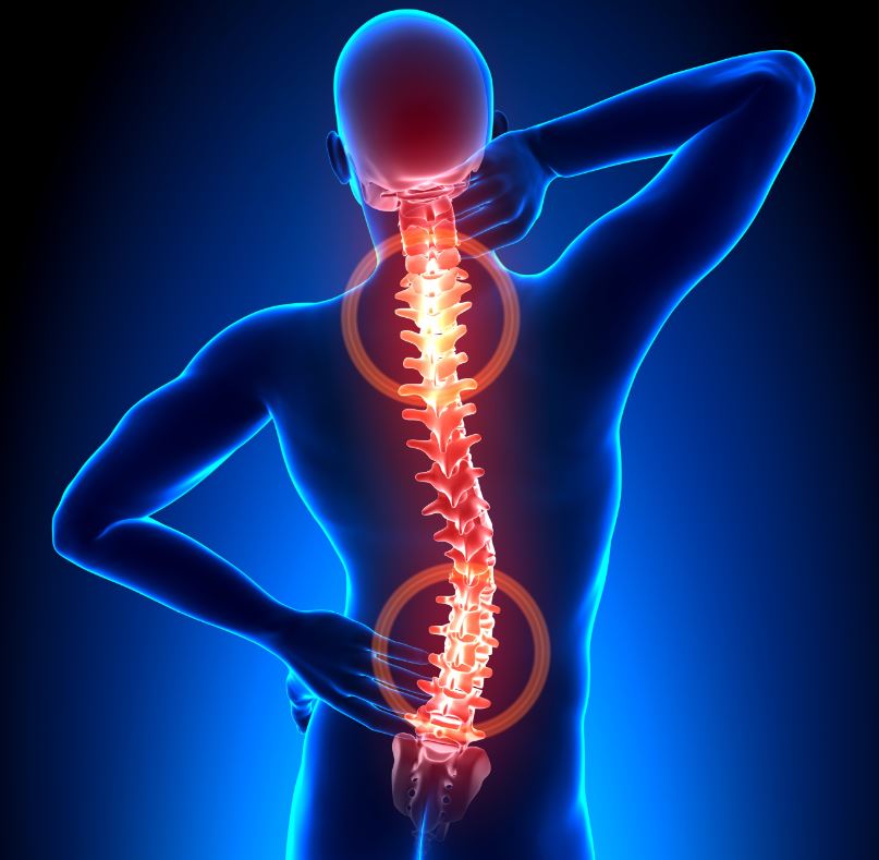 facettensyndrom wirbelsaeule