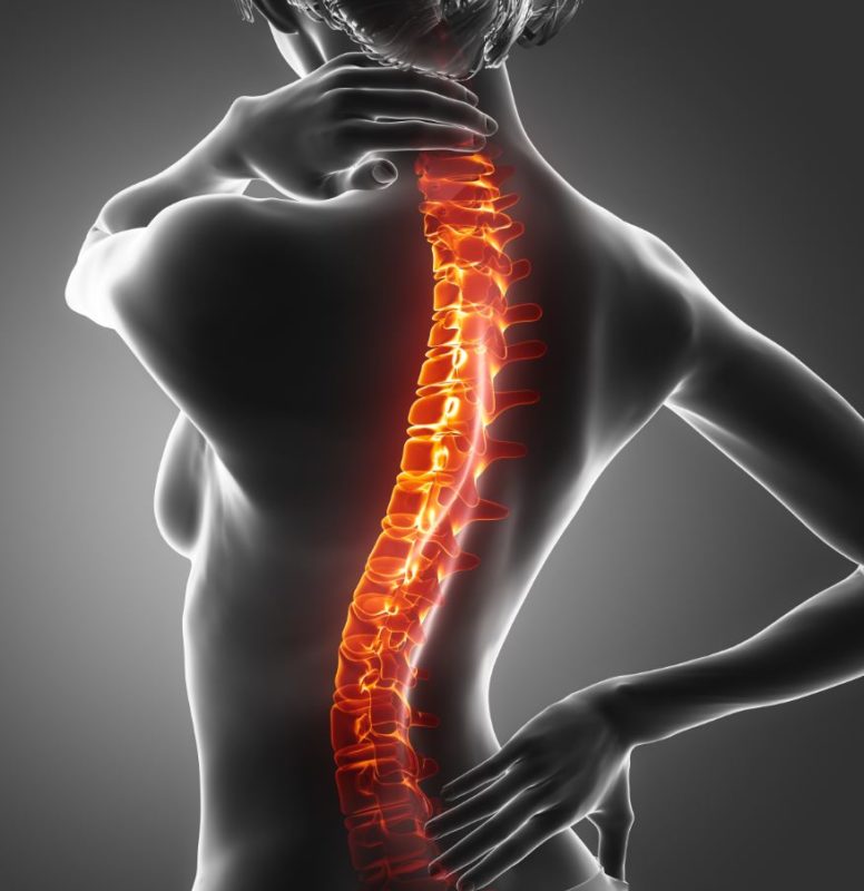 schmerzen wegen gleitwirbel