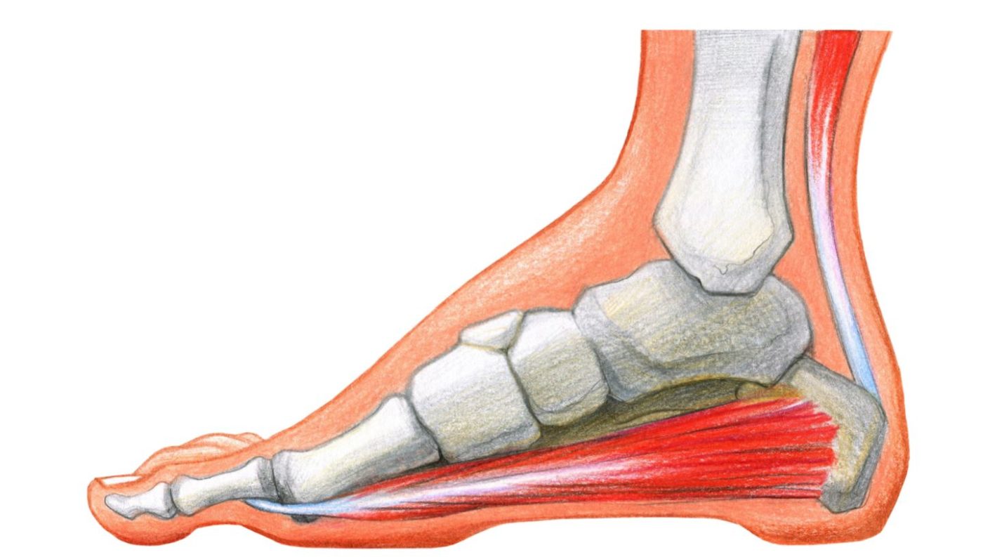 hallux rigidus