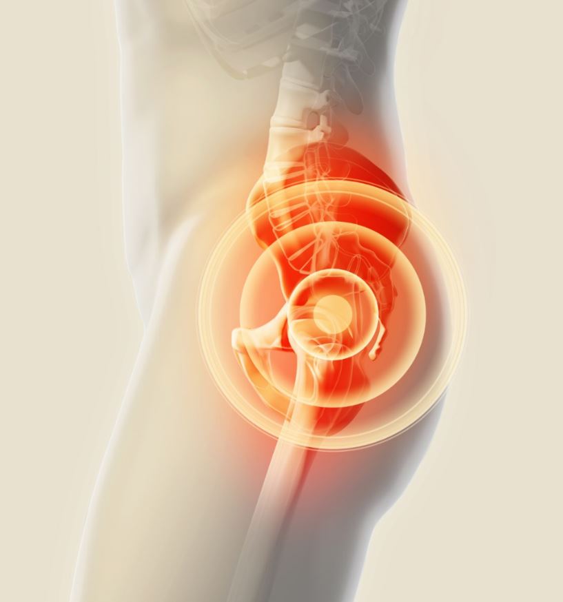 Hüftdysplasie Ursachen Symptome Behandlungen